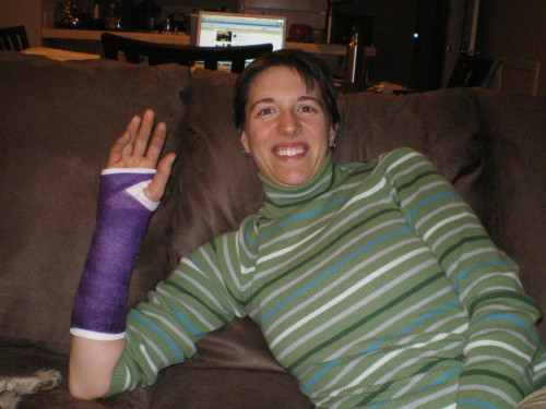 Jess in a purple cast on her broken wrist.